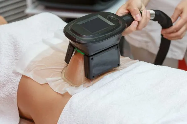 Image of person having fat freezing treatment to help weight gain Norwich