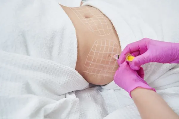 image of fat dissolving injections on love handles to help combat weight gain Norwich