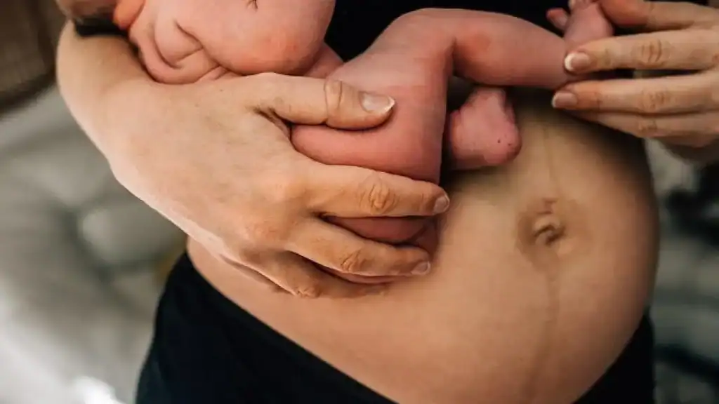 Why Is My Stomach Still Big After Pregnancy Norwich?